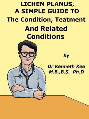 Cover of the book Lichen Planus, A Simple Guide To The Condition, Treatment And Related Conditions by Kenneth Kee
