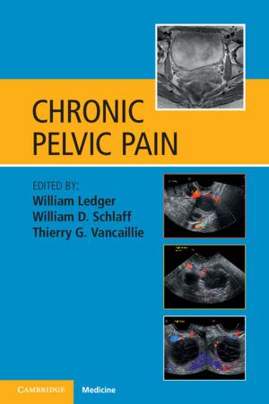 Cover of the book Chronic Pelvic Pain by Tony Kelbrat