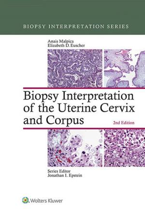 Cover of the book Biopsy Interpretation of the Uterine Cervix and Corpus by Howard Silberman, Allan W. Silberman