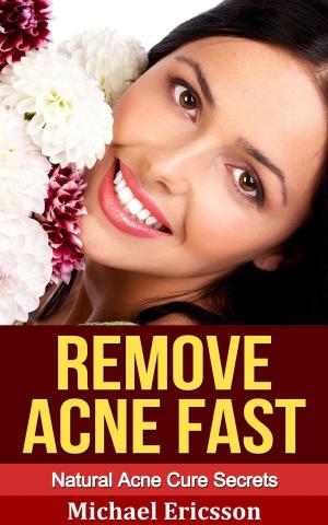 Book cover of Remove Acne Fast: Natural Acne Cure Secrets
