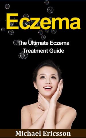 Book cover of Eczema: The Ultimate Eczema Treatment Guide