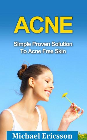 Book cover of Acne: Simple Proven Solution To Acne Free Skin