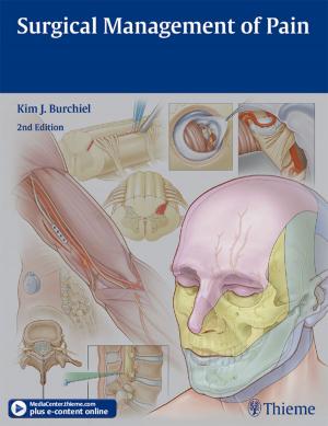 Cover of the book Surgical Management of Pain by Michael Schuenke, Erik Schulte, Udo Schumacher