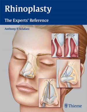 Cover of the book Rhinoplasty by E. Sander Connolly, Guy M. McKhann II, Judy Huang