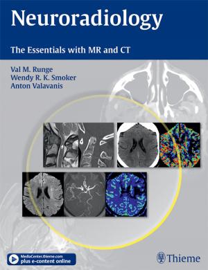 Cover of the book Neuroradiology by Alan Cohen