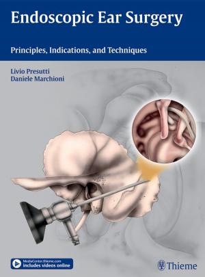 Cover of the book Endoscopic Ear Surgery by Todd S. Ellenbecker