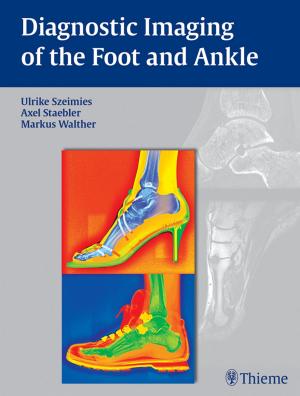 Book cover of Diagnostic Imaging of the Foot and Ankle