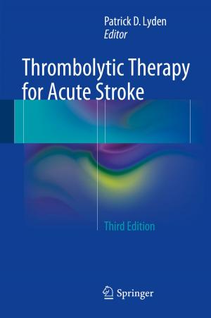 Cover of the book Thrombolytic Therapy for Acute Stroke by Pádraig Ó Riagáin