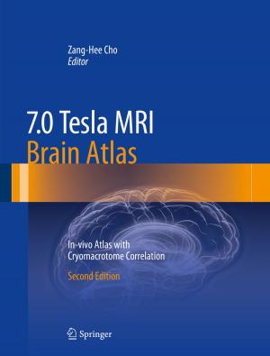 Cover of the book 7.0 Tesla MRI Brain Atlas by Steffen Fröhlich