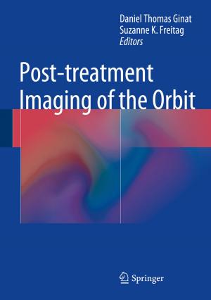 Cover of the book Post-treatment Imaging of the Orbit by Theagarten Lingham-Soliar