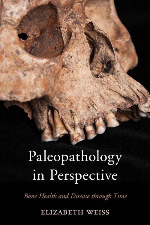 Cover of the book Paleopathology in Perspective by Elizabeth Weiss, Rowman & Littlefield Publishers