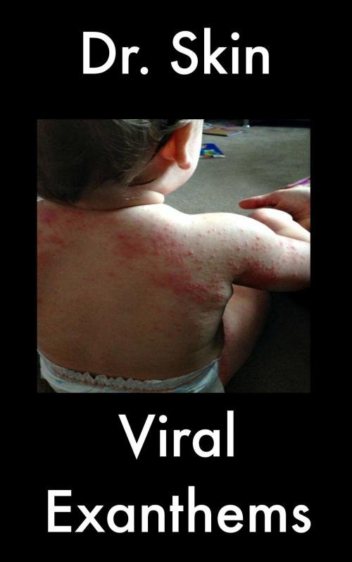 Cover of the book Viral Exanthems by Dr Skin, Dr Skin
