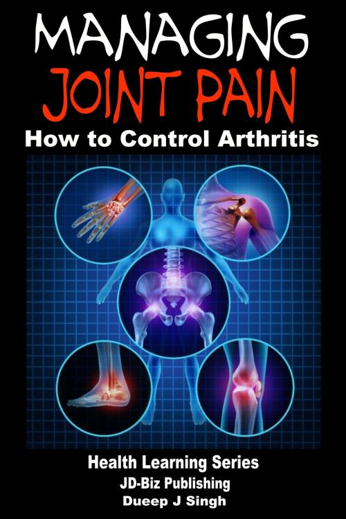 Cover of the book Managing Joint Pain: How to Control Arthritis by Dueep J. Singh, Mendon Cottage Books