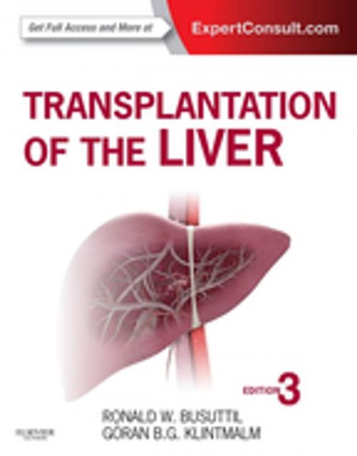 Cover of the book Transplantation of the Liver E-Book by Ronald W. Busuttil, MD, PhD, Goran B. Klintmalm, MD, PhD, Elsevier Health Sciences