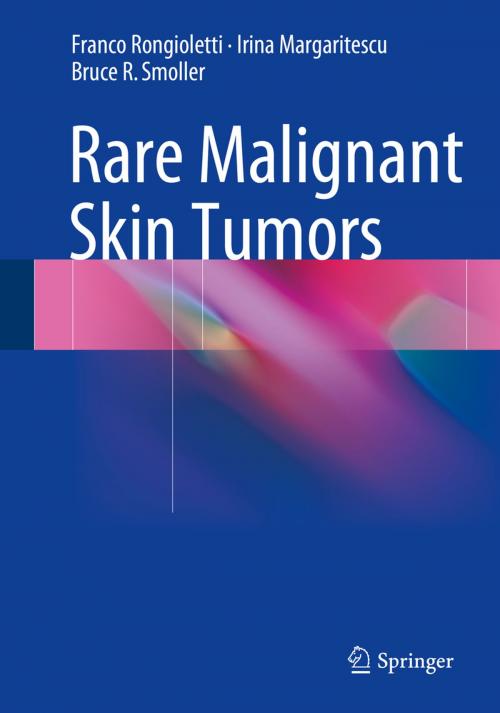 Cover of the book Rare Malignant Skin Tumors by Franco Rongioletti, Irina Margaritescu, Bruce R Smoller, Springer New York