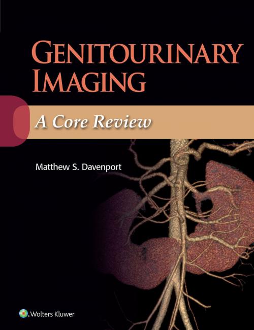 Cover of the book Genitourinary Imaging: A Core Review by Matthew Davenport, Wolters Kluwer Health