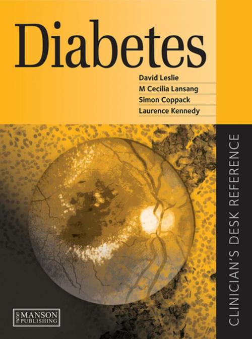 Cover of the book Diabetes by David Leslie, Cecilia Lansang, Simon Coppack, Laurence Kennedy, CRC Press