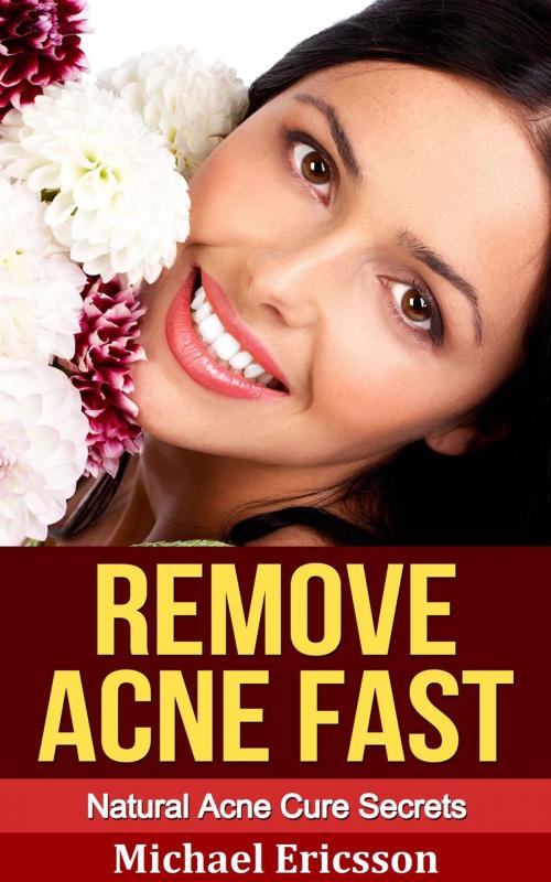 Cover of the book Remove Acne Fast: Natural Acne Cure Secrets by Dr. Michael Ericsson, Dr. Michael Ericsson