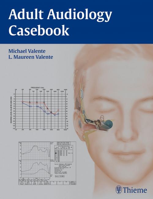 Cover of the book Adult Audiology Casebook by Michael Valente, L. Maureen Valente, Thieme