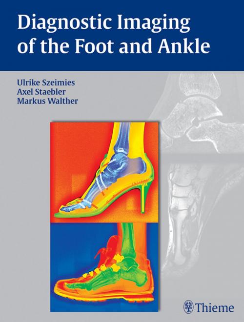 Cover of the book Diagnostic Imaging of the Foot and Ankle by Ulrike Szeimies, Axel Stbler, Markus Walther, Thieme