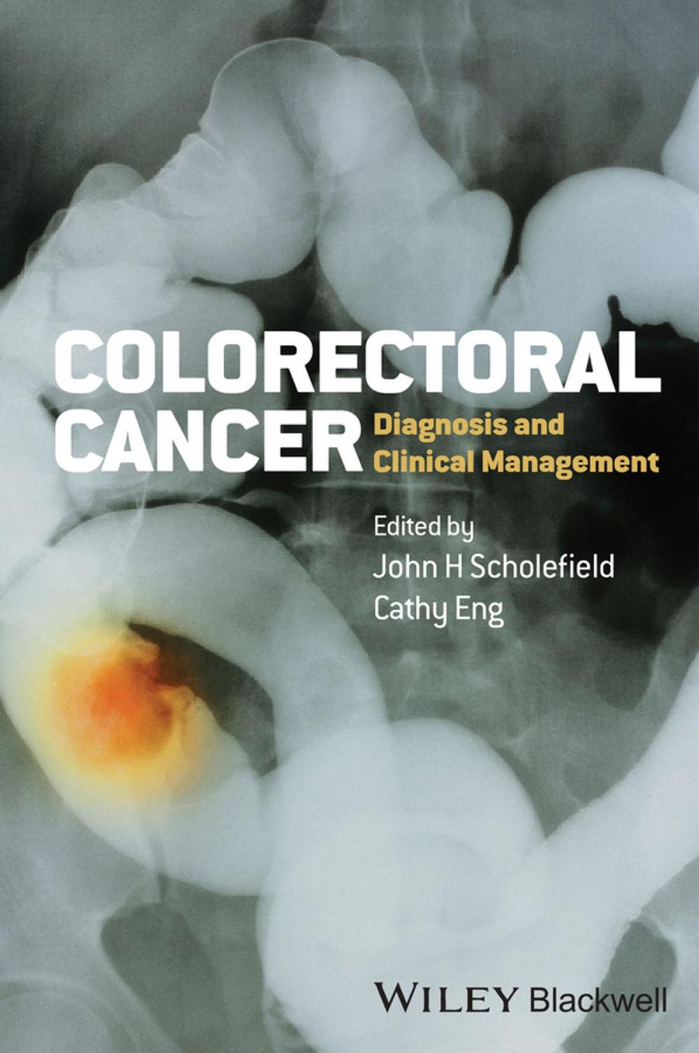 Big bigCover of Colorectal Cancer