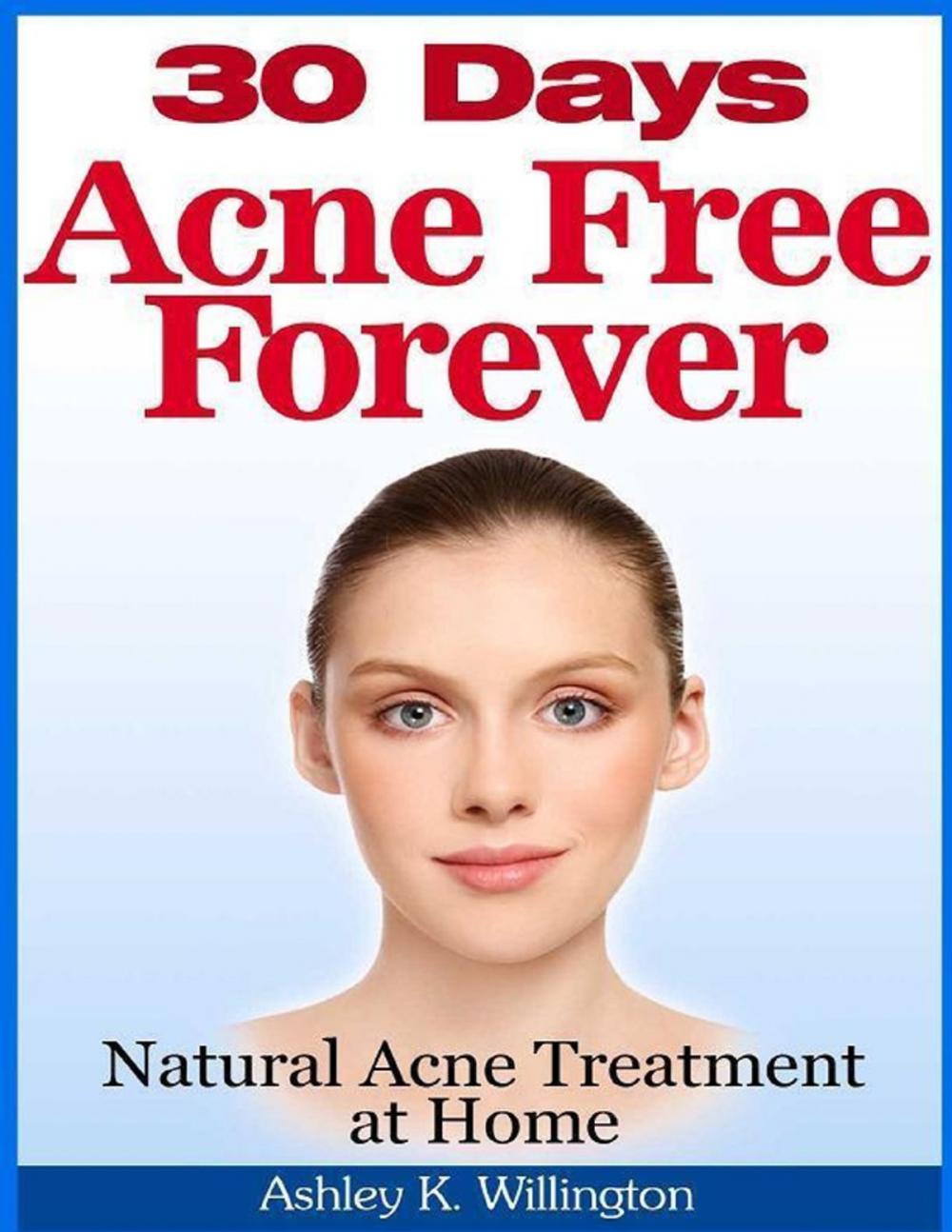 Big bigCover of 30 Days Acne Free Forever: Natural Acne Treatment at Home