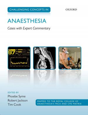 Cover of the book Challenging Concepts in Anaesthesia by Martin Thomas, Richard Toye