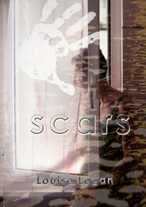 Cover of the book Scars - Breaking free from abuse by 陳嘉堡