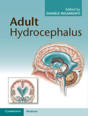 Cover of the book Adult Hydrocephalus by Amit Hagar