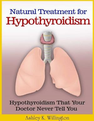 Book cover of Natural Treatment for Hypothyroidism: Hypothyroidism That Your Doctor Never Tell You