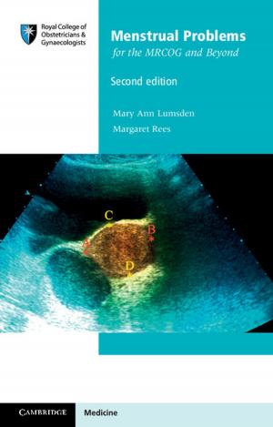 Cover of Menstrual Problems for the MRCOG and Beyond