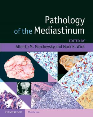 Cover of the book Pathology of the Mediastinum by Lester Brickman