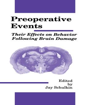 Cover of the book Preoperative Events by Clive Chappell, Carl Rhodes, Nicky Solomon, Mark Tennant, Lyn Yates