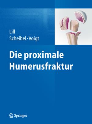 Cover of the book Die proximale Humerusfraktur by Engelbert Westkämper, Carina Löffler