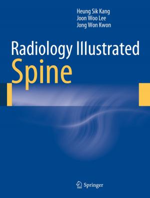Cover of the book Radiology Illustrated: Spine by Walther Busse von Colbe, Gert Laßmann, Frank Witte