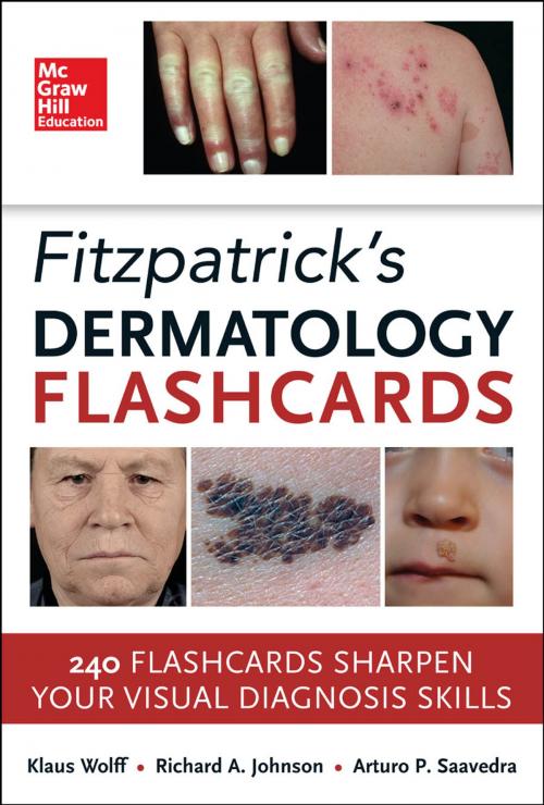 Cover of the book Fitzpatricks Dermatology Flash Cards by Richard Allen Johnson, Arturo Saavedra, Klaus Wolff, McGraw-Hill Education