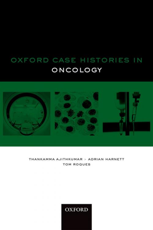 Cover of the book Oxford Case Histories in Oncology by , OUP Oxford