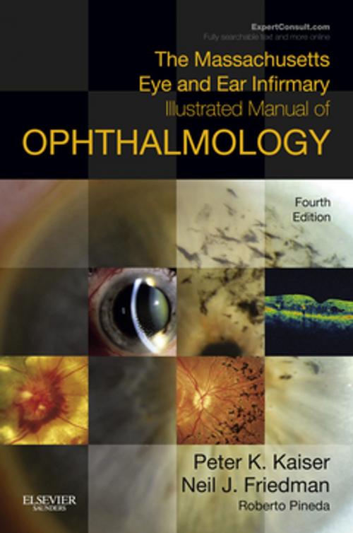 Cover of the book The Massachusetts Eye and Ear Infirmary Illustrated Manual of Ophthalmology E-Book by Neil J. Friedman, MD, Peter K. Kaiser, MD, Roberto Pineda II II, MD, Elsevier Health Sciences