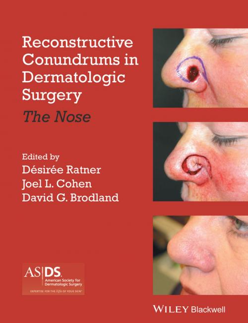 Cover of the book Reconstructive Conundrums in Dermatologic Surgery by , Wiley