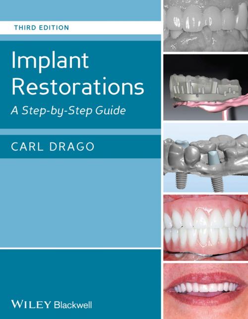 Cover of the book Implant Restorations by Carl Drago, Wiley