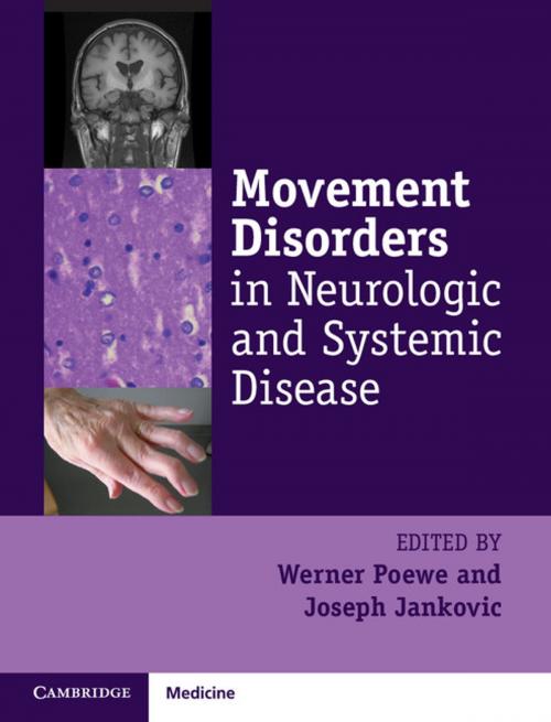 Cover of the book Movement Disorders in Neurologic and Systemic Disease by , Cambridge University Press