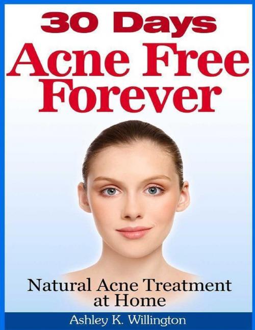 Cover of the book 30 Days Acne Free Forever: Natural Acne Treatment at Home by Ashley K. Willington, Lulu.com