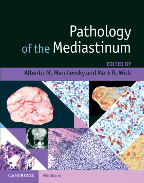 Cover of the book Pathology of the Mediastinum by , Cambridge University Press
