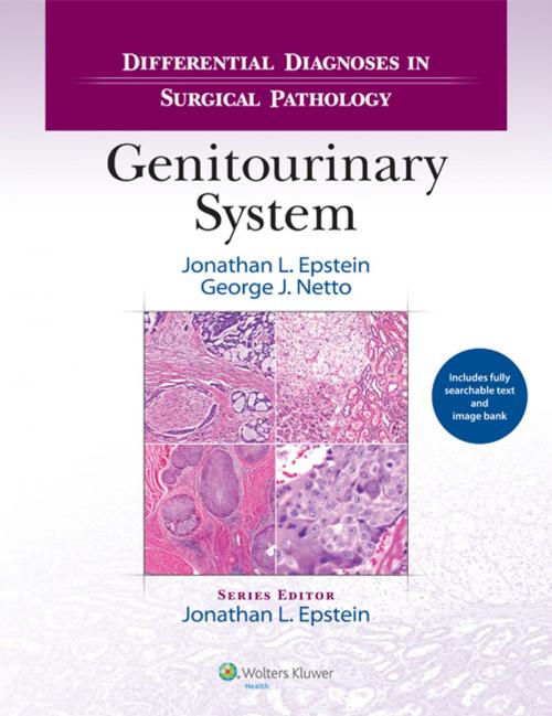 Cover of the book Differential Diagnoses in Surgical Pathology: Genitourinary System by Jonathan I. Epstein, George J. Netto, Wolters Kluwer Health
