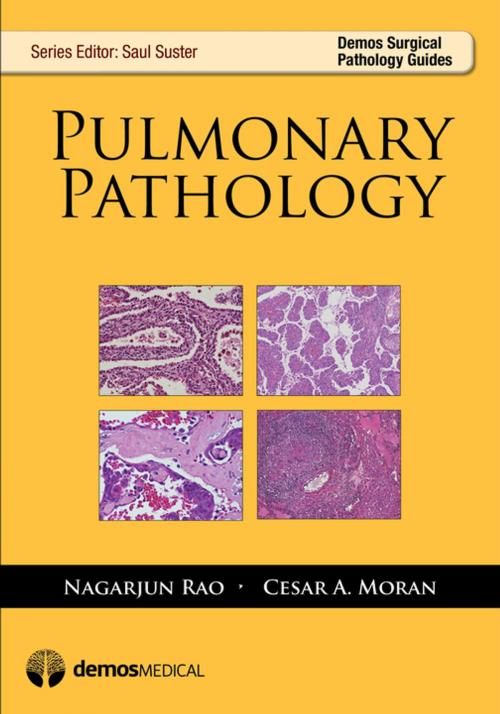 Cover of the book Pulmonary Pathology by Cesar Moran, MD, R. Rao, MD, Saul Suster, MD, Springer Publishing Company