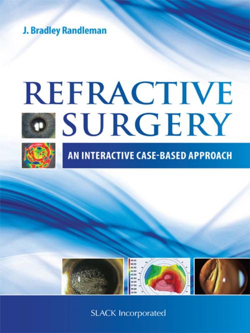 Cover of the book Refractive Surgery by , SLACK Incorporated