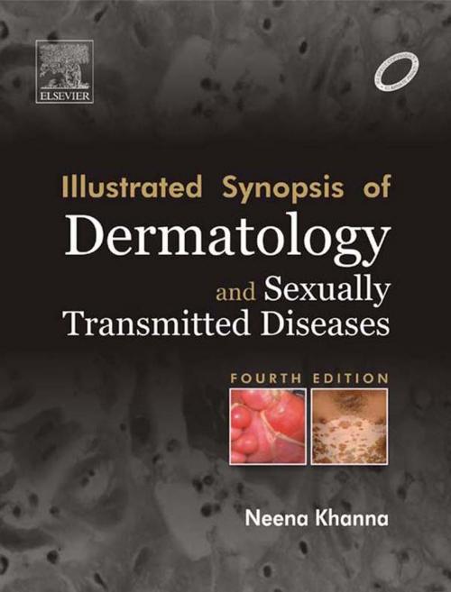 Cover of the book Illustrated Synopsis of Dermatology & Sexually Transmitted Diseases - E-book by Neena Khanna, Elsevier Health Sciences