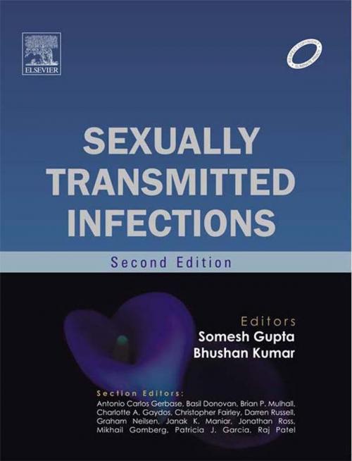 Cover of the book Sexually Transmitted Infections - E-book by Somesh Gupta, Bhushan Kumar, MD MNAMS, Elsevier Health Sciences