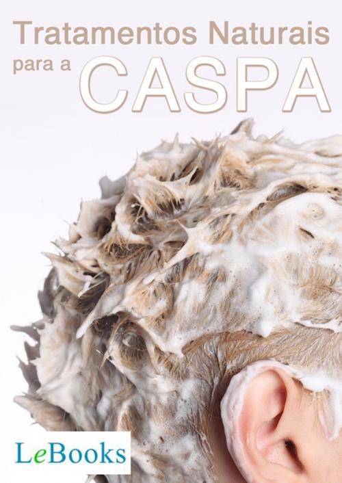 Cover of the book Tratamentos naturais para a caspa by Edições Lebooks, Lebooks Editora