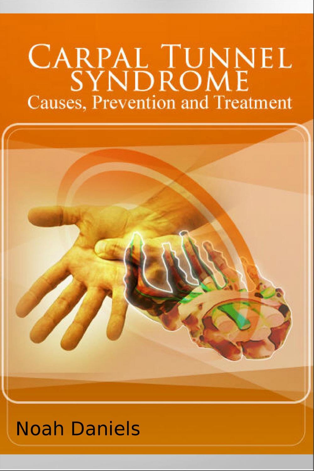 Big bigCover of Carpal Tunnel Syndrome - Causes, Prevention and Treatment